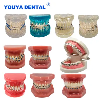 Ортодонтическое Лечение зубов Обучение Модели Зубов Изучение Моделей Десен Зубов С Орто Металлическим Кронштейном Дугообразной Проволочной Лигатурой Dentis  4